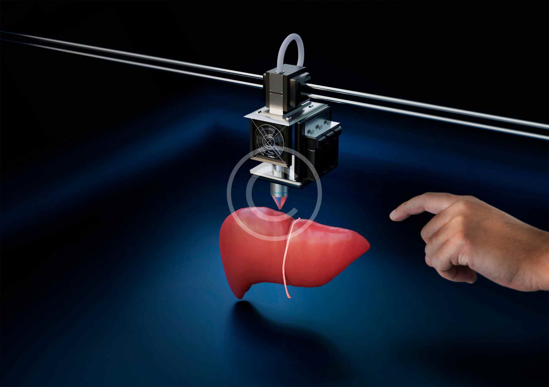 Artificial organs 1 Artificial organs